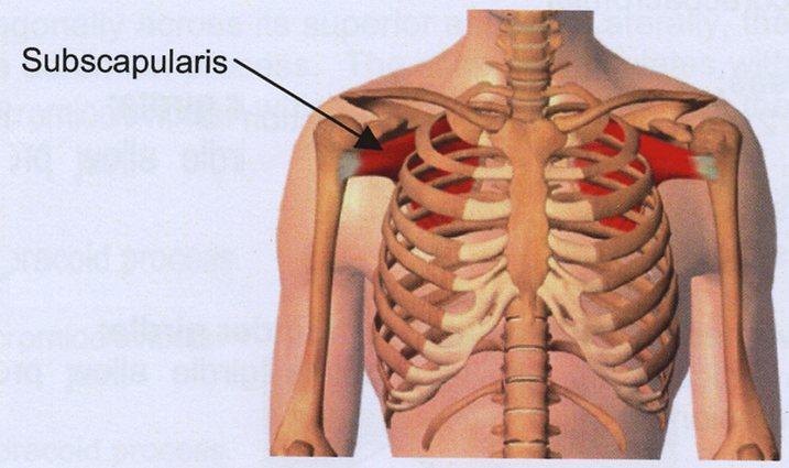 Subscapularis Tear In Muscle 101